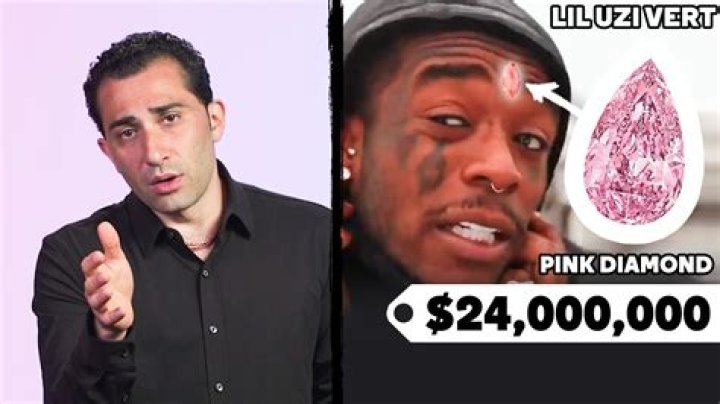 Did Lil Uzi remove his diamond?