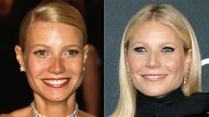 
Has Actress Gwyneth Paltrow Done Plastic Surgery With Her Before And After Photos 