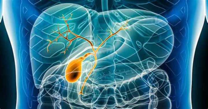 Mercedes LeAnza Bile Duct Cancer: What happened to Mercedes LeAnza?