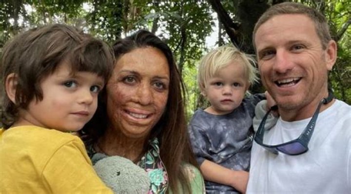 Turia Pitt Children: Who Are Rahiti Hoskin And Hakavai Hoskin? Their Age Gap Explored