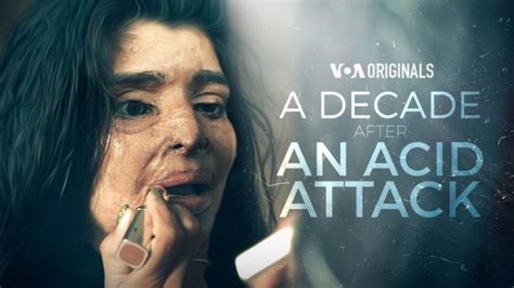 
What Happened To Mark Van Dongen Face? Death Or Alive, Where Is Acid Attack Victim Now? 