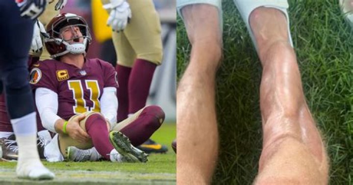 
Where Is Alex Smith Now? Did He Retire After His Leg Surgery? 
